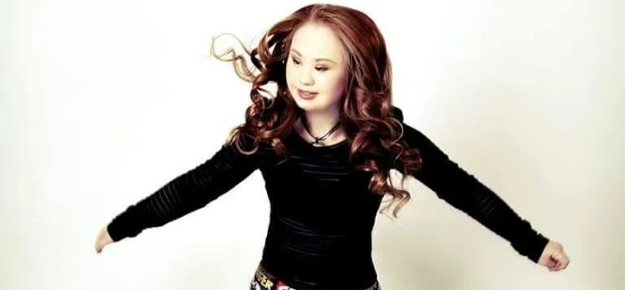 Madeline Stuart u misiji promjene percepcije osoba sa sindromom Down