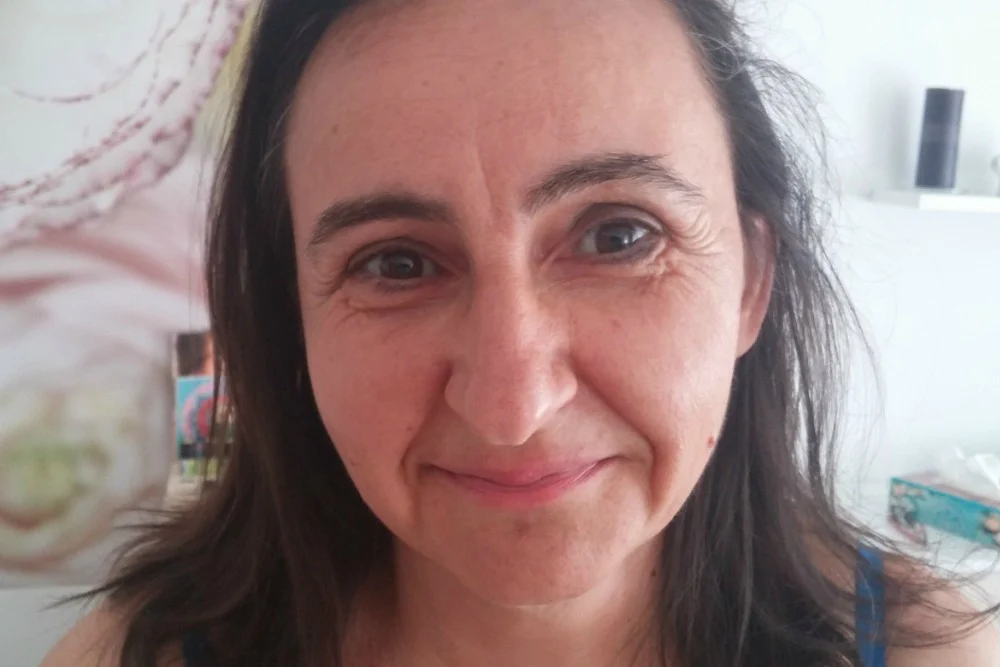 I druga WiA članica krenula s makeoverom lica u Ageness Beauty Institutu