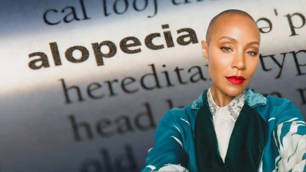 Dugogodišnja borba s alopecijom Jade Pinkett Smith u pozadini incidenta na Oscarima