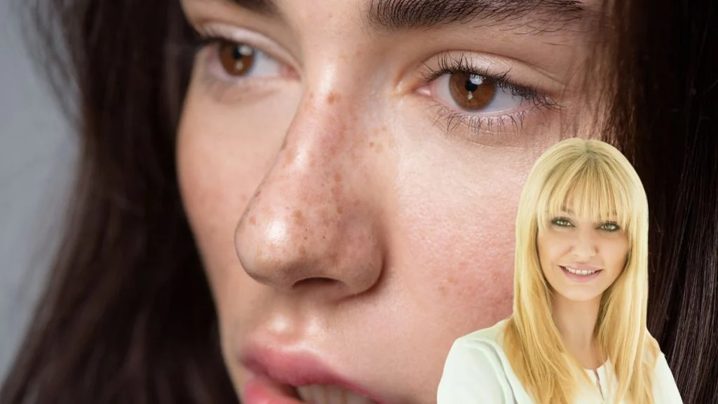 Obnovite kožu nakon ljeta uz nježan HydraFacial tretman