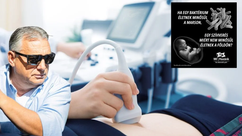 Mađarice moraju slušati otkucaje srca fetusa prije no što pobace?!