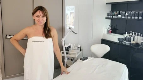 Microneedling nakon kojeg se odmah vraćate na posao
