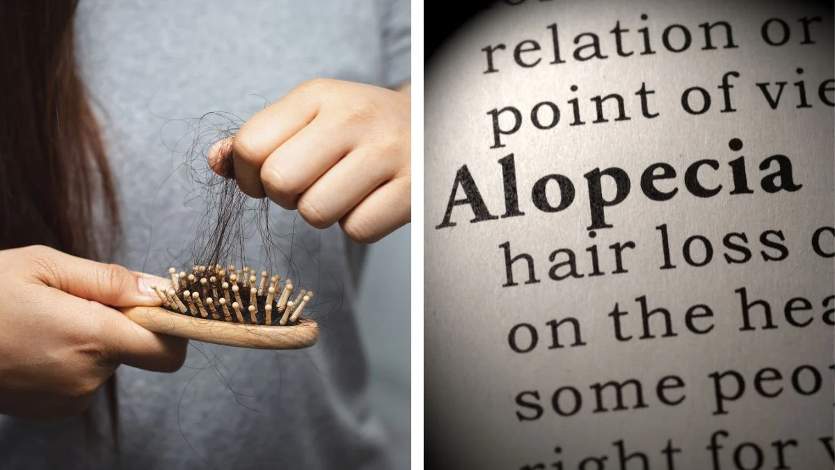 Piće omiljeno u Hrvata ima opasnu nuspojavu: Povezano je s alopecijom