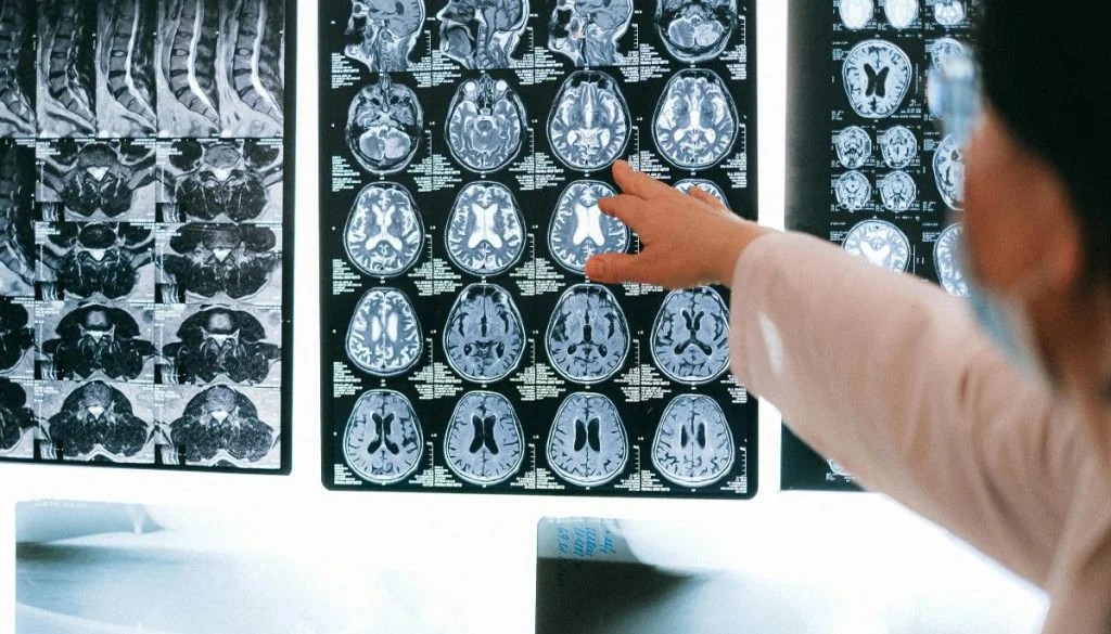 Pretjerani rad fizički mijenja volumen mozga i utječe na sposobnosti, pokazuje novo izvješće