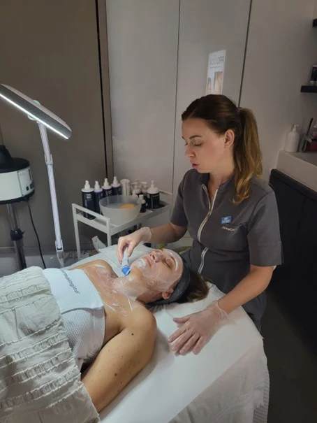 microneedling